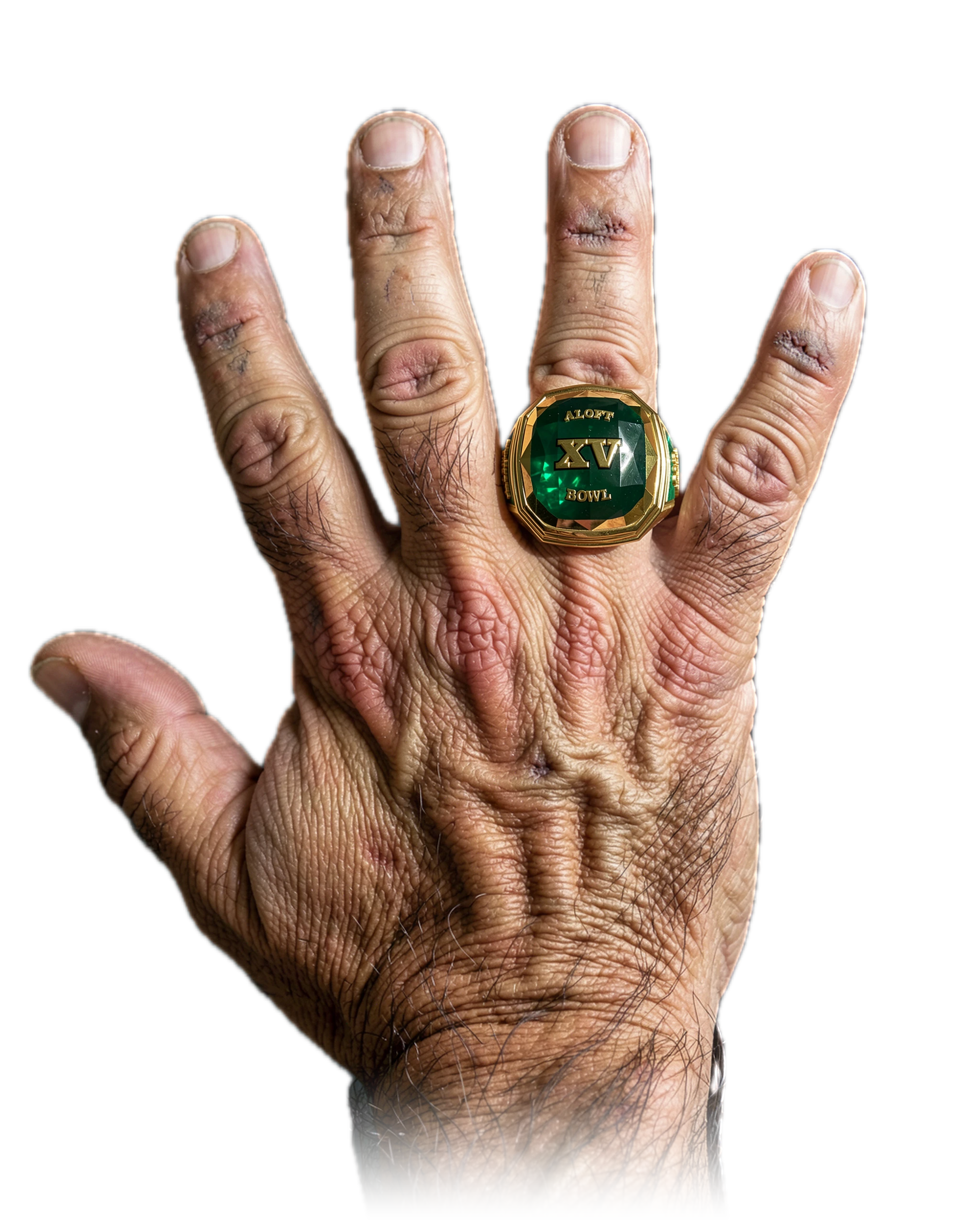 Dan Weissburg's 1 ALOFT Bowl championship rings, worn on one hand