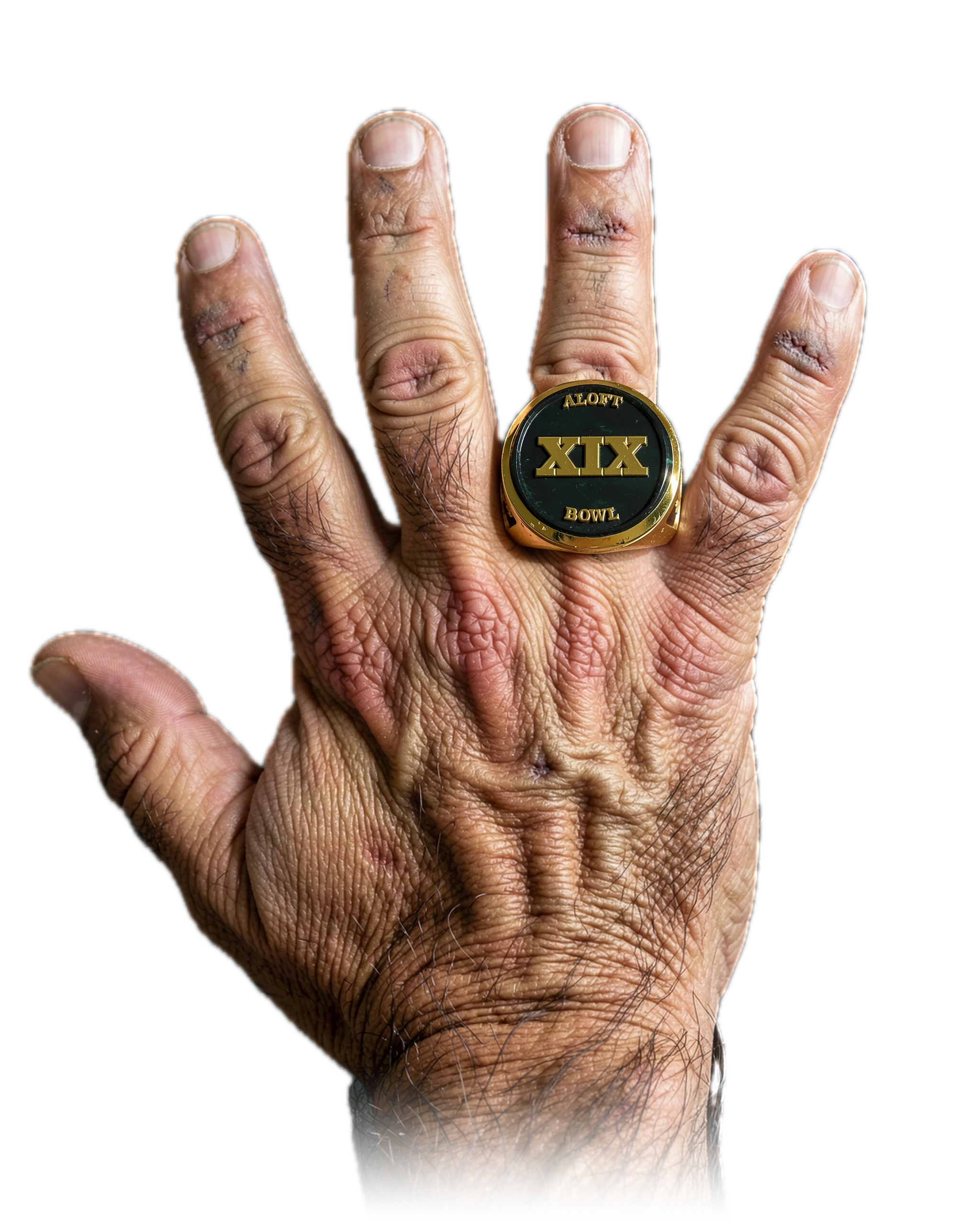 Matt Pugh's 1 ALOFT Bowl championship rings, worn on one hand