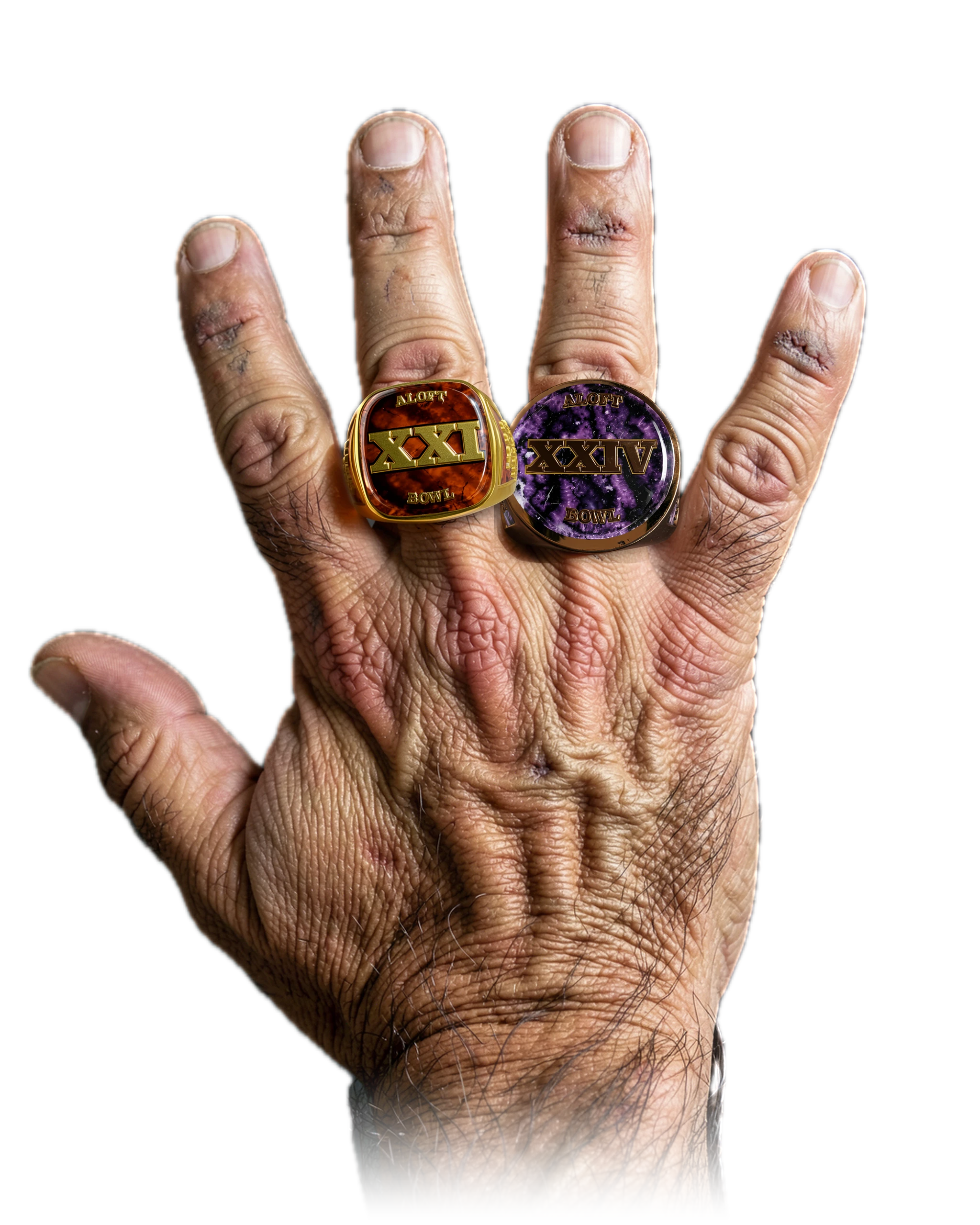 Todd Mercer's 2 ALOFT Bowl championship rings, worn on one hand